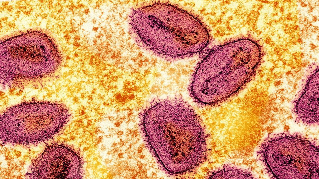 Two more cases of new mpox strain detected in UK